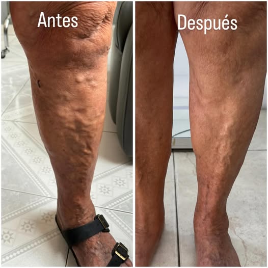 Calcetas Essenza de Compresión de 15-20mmHg